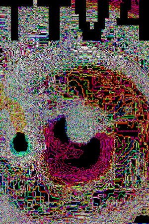 TTV4