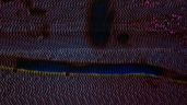 Ultraview Module