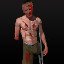 Just a Flesh Wound
