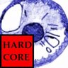 Won Game: Agony Hardcore