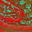 Greed