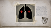 Conserving oxygen