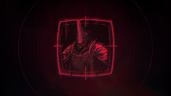 Voidfract